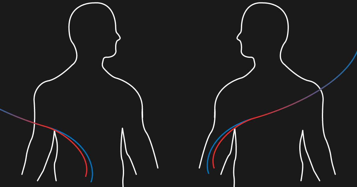 hemodialysis-vs-peritoneal-dialysis